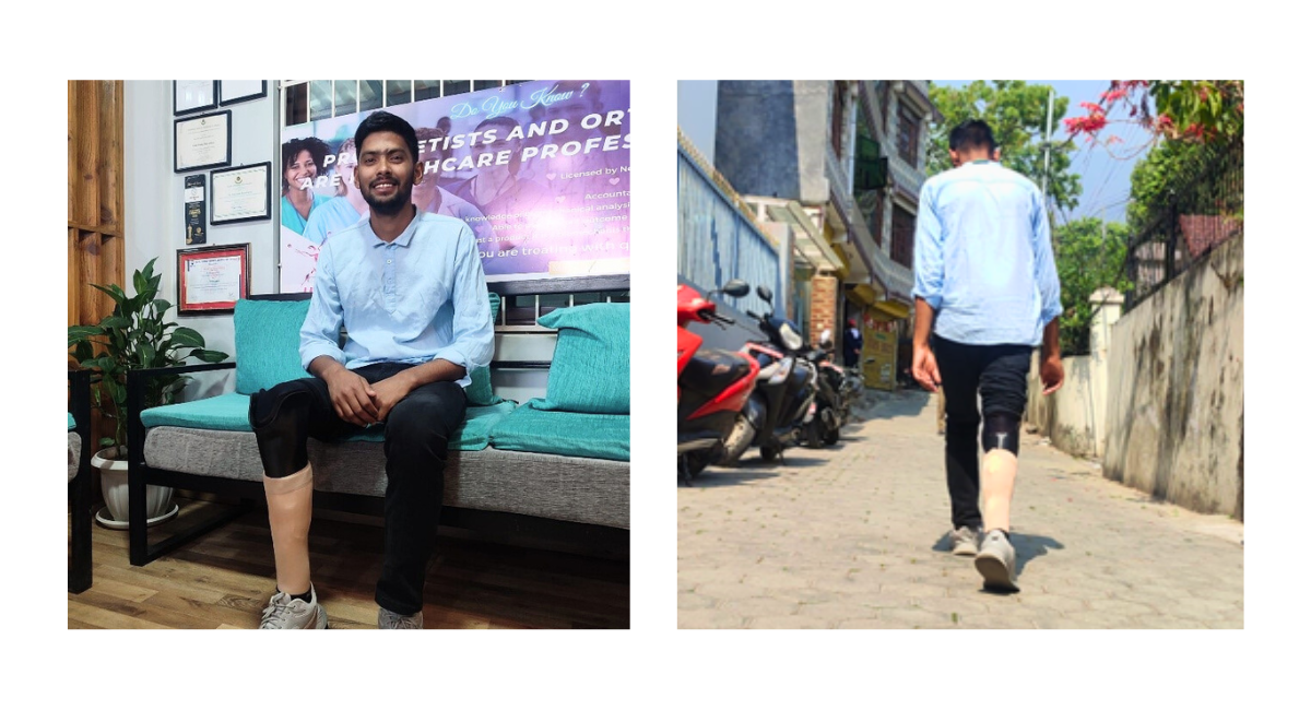 Left: Aakash smiling on a chair with his prosthetic limb. Right: Aakash walking down a street with his prosthetic limb.