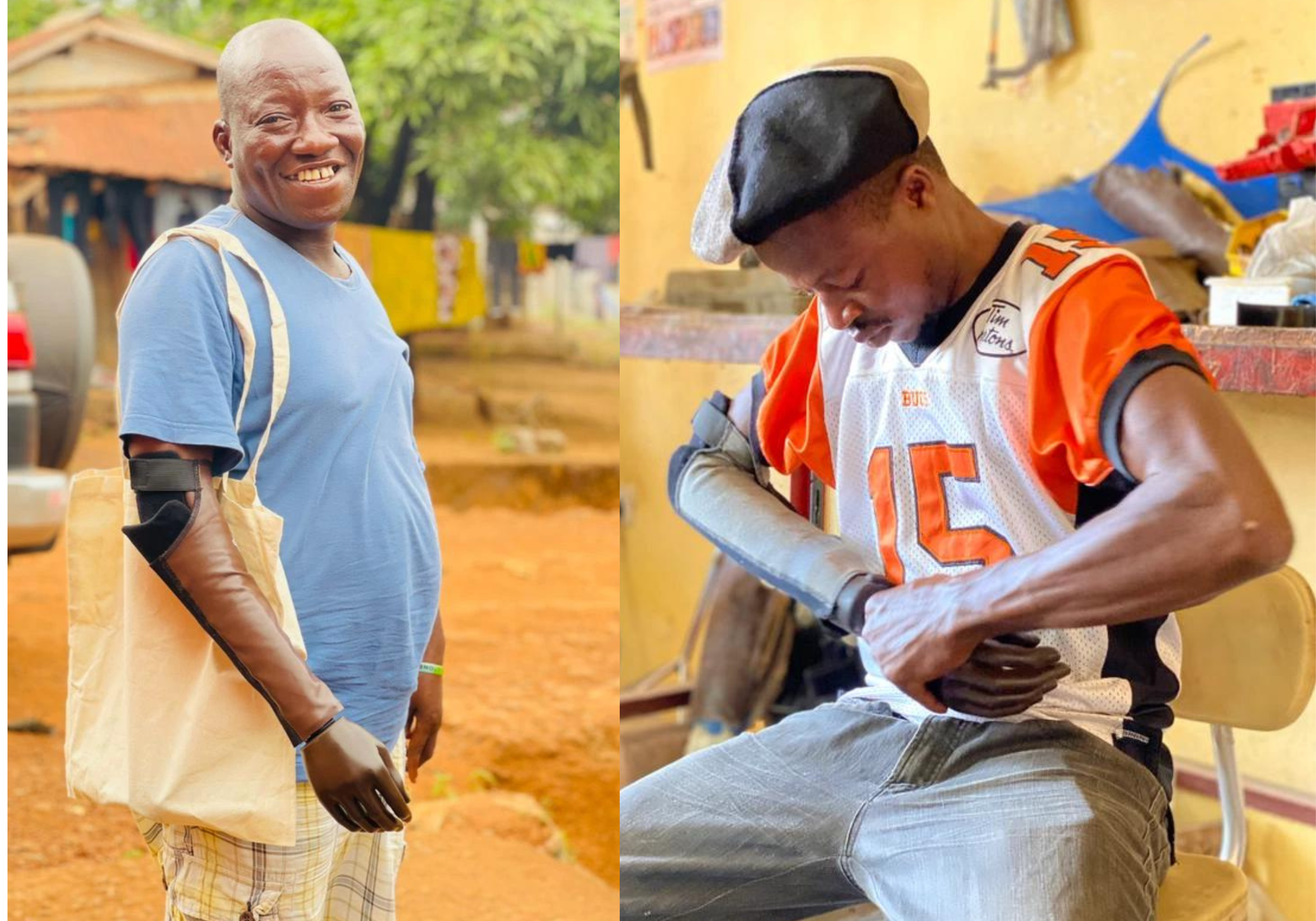 Two photos side-by-side of upper limb AT users. The one on the left is of a man standing with his prosthesis. The one on the right is of a man fitting his own prosthesis Cover Image