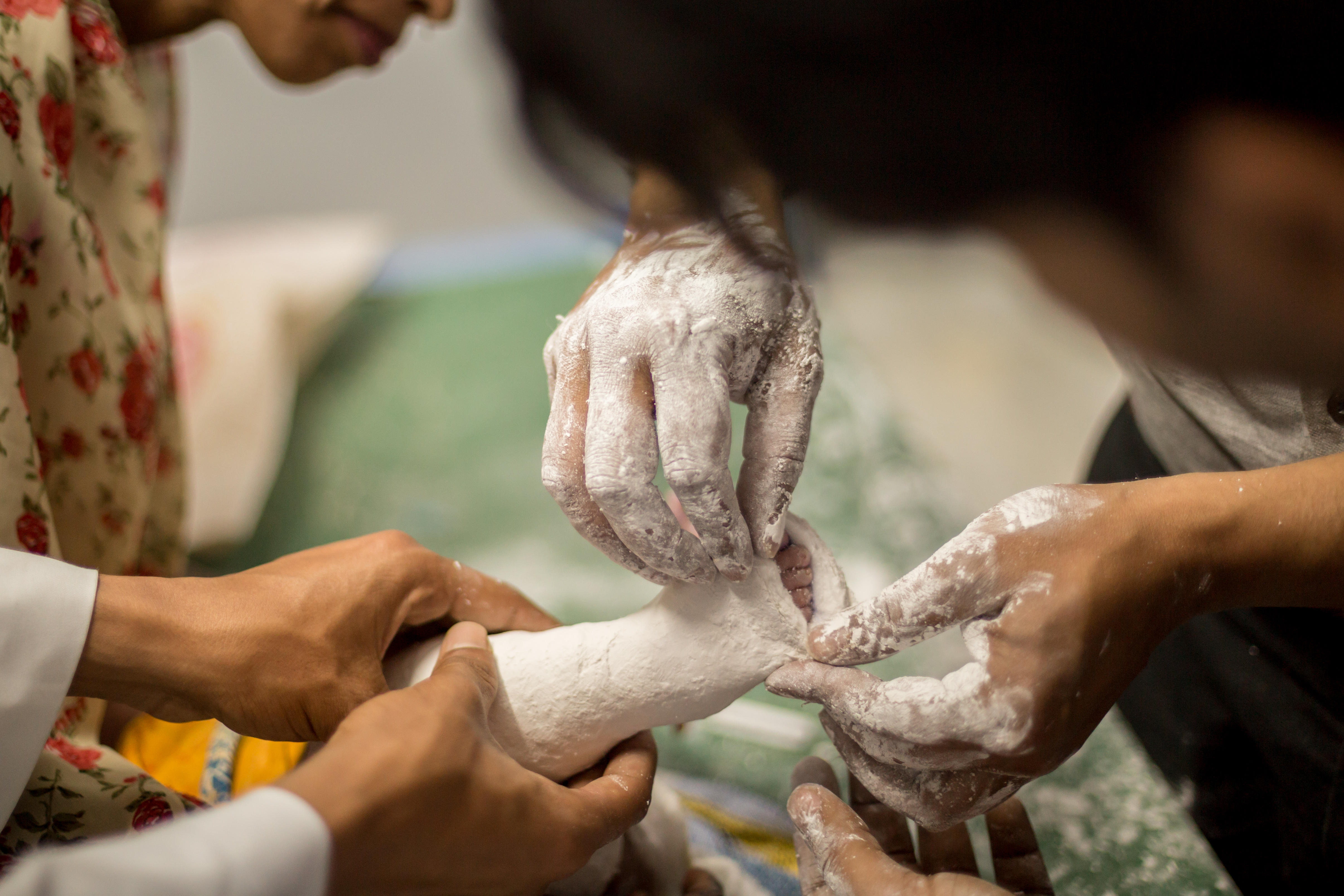 A close up photo of a healthcare professional putting a cast on a baby's leg